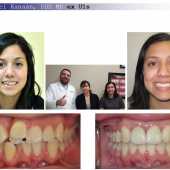 complex orthodontic case 5