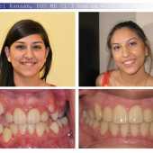 orthodontic case 1