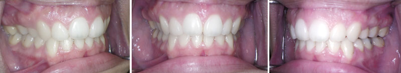 6 month follow up