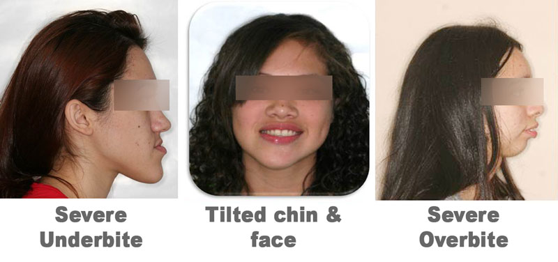 cases requiring jaw surgery