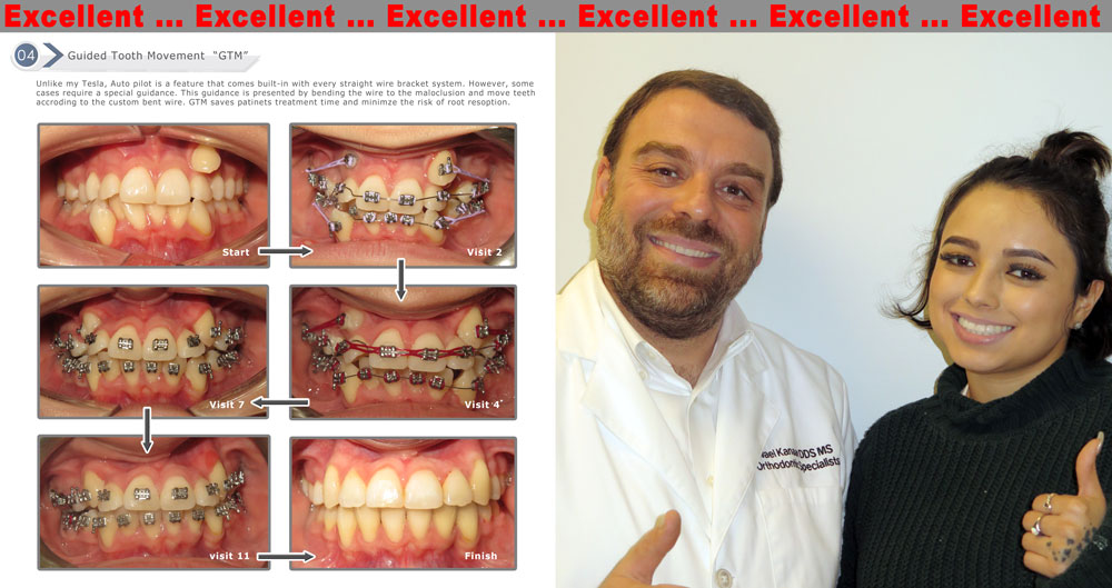 Best Orthodontist in Sugarland