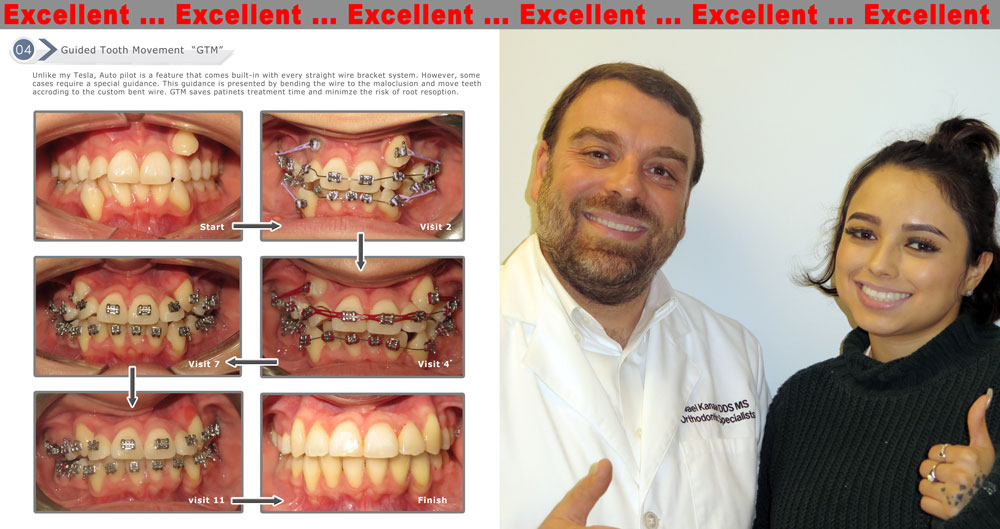 Guided tooth movement Orthodontist near me Houston