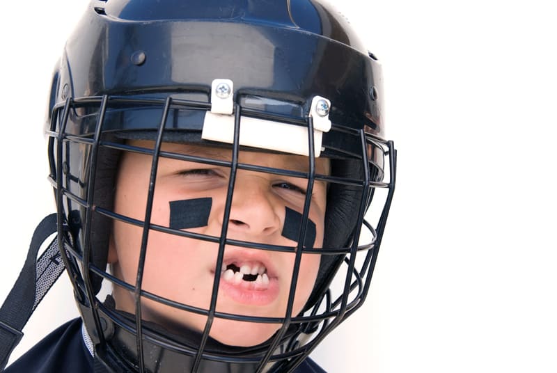 A small boys face showing missing teeth wearing a helmet with protective face gear