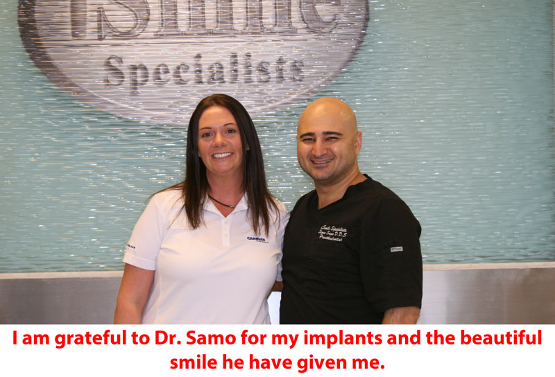 dental implant Sugar Land
