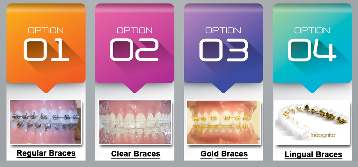 Brace