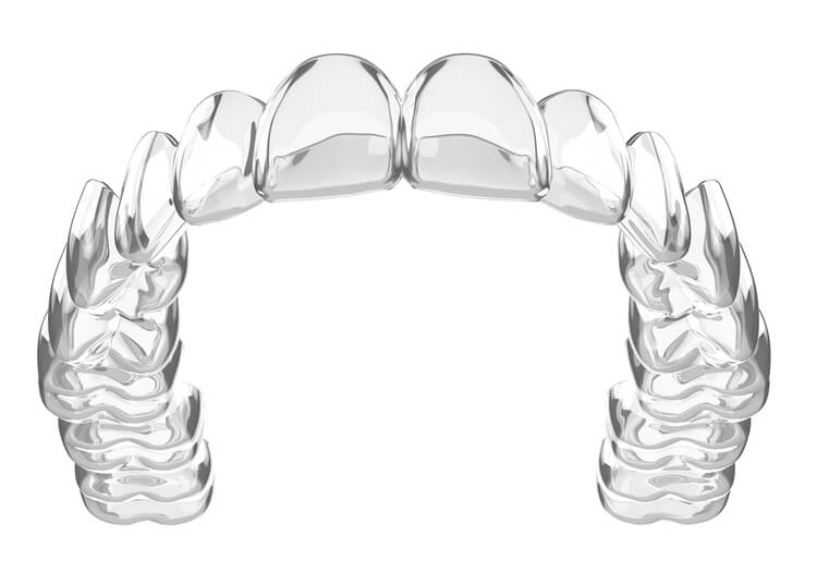 Invisalign Clear Aligners