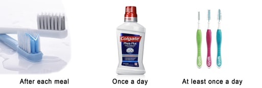 What you need to brush your teeth with braces