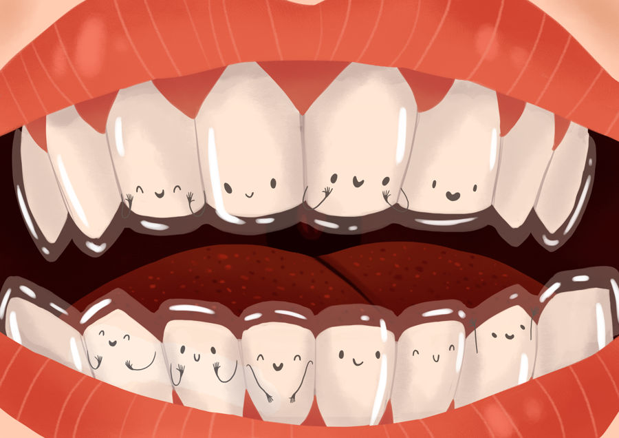 invisalign houston