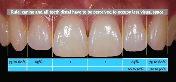 Complex orthodontic case 2