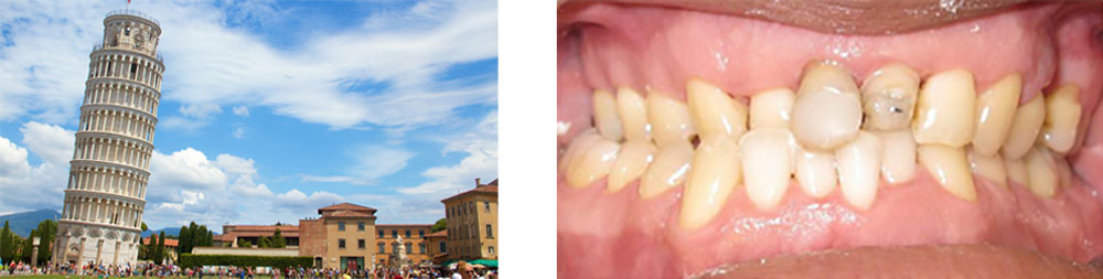 Complex Orthodontic case 4