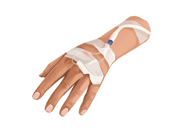 IV Sedeation