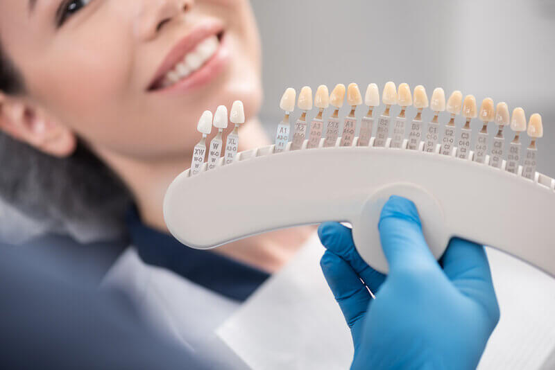 Veneers Houston