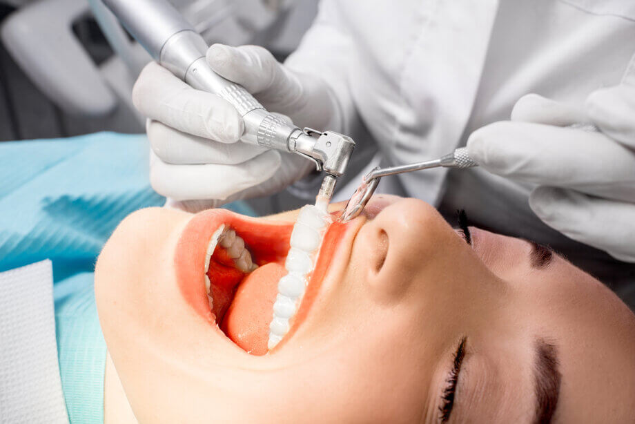 teeth cleaning Houston