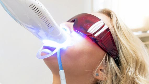 Zoom Teeth Whitening