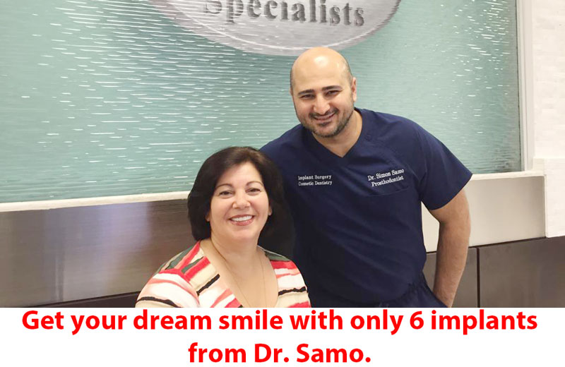 best dental implant sugar land