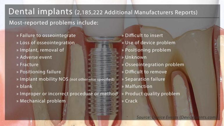 Problems with dental Implants from FDA Problems with dental Implants from FDA