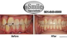 orthodontist in sugar land 