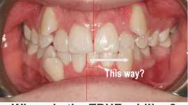 Midline correction in Houston