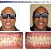 complex orthodontic case 7
