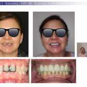 complex orthodontic case 8