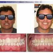 complex orthodontic case 9