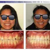 complex orthodontic case 10