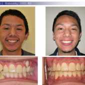 orthodontic case 