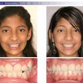 orthodontic case 