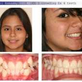 orthodontic case 