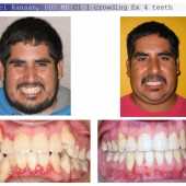 orthodontic case 