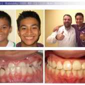 orthodontic case before and after