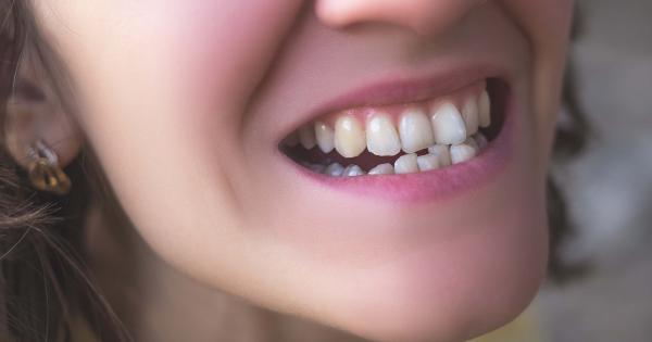 do crooked baby teeth mean braces