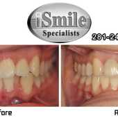 orthodontist in sugar land