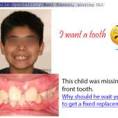 Temporary Implant for growing child